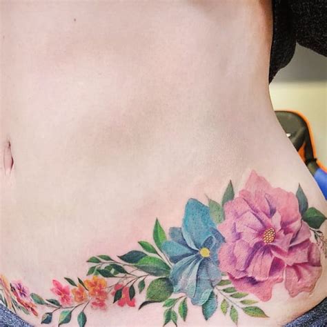 tummy tuck tattoo cover up|tummy tuck tattoo butterflies.